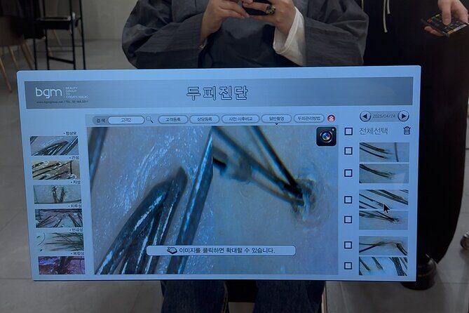 15 Step Stem Cell Scalp Treatment in Seoul - Authentic Perspectives from Travelers
