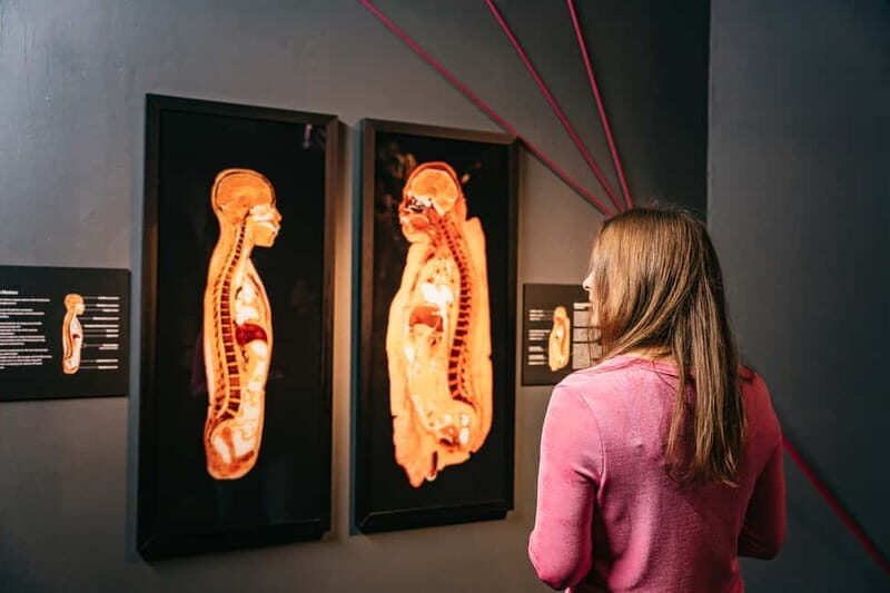 Berlin: Tickets for the BODY WORLDS Museum in Berlin - The Sum Up: Why You Shouldn’t Miss It