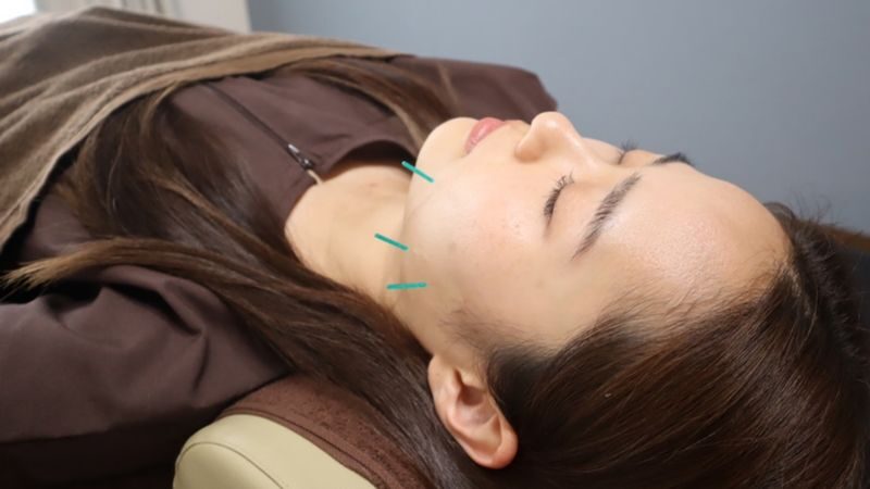 Japan Tokyo Acupuncture Clinic Reconditioning Jiyugaoka - At a glance