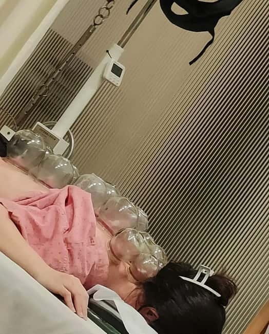 Shanghai: Chinese Medicine Acupuncture and Cupping Session - What to Expect from Your Chinese Medicine Experience in Shanghai