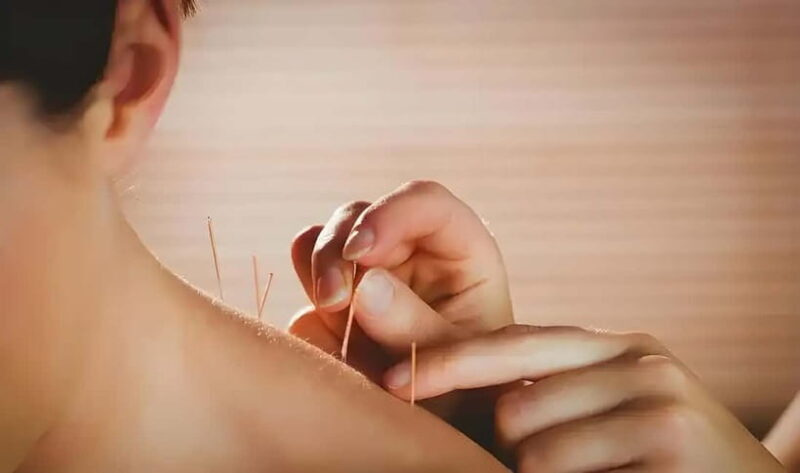 Shenzhen: Acupuncture Experience with TCM Practitioner - What to Expect from Your Acupuncture Experience in Shenzhen