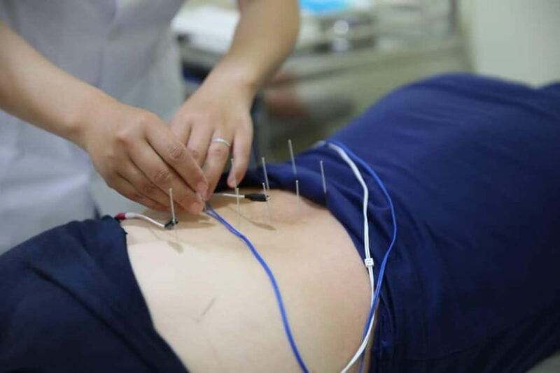 Shenzhen: Acupuncture Experience with TCM Practitioner - Final Thoughts